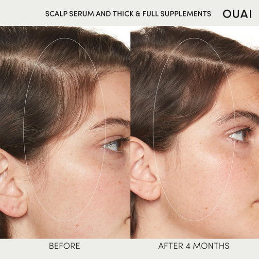 OUAI Scalp Serum - Balancing and Hydrating Serum with Red Clover Extract, Siberian Ginseng and Peptides for Thicker and Fuller-Looking Hair - Paraben, Phthalate and Sulfate Free Scalp Care (2 Fl Oz)