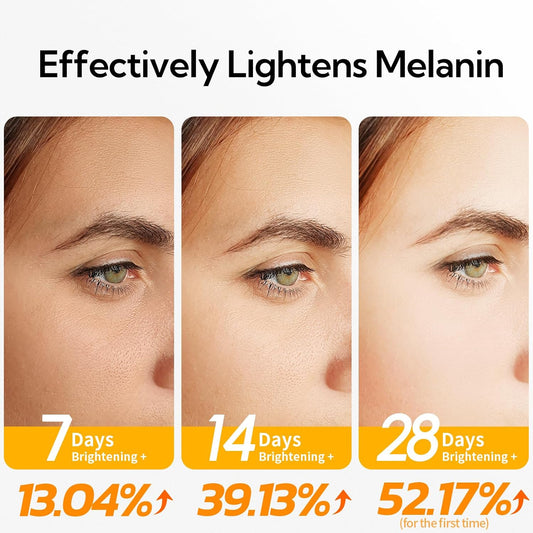 20% Vitamin C Serum For Face, 30 Ml/ 1 Fl, Brightening Skin, Dark Spot Remover, Reduce Wrinkle, Anti Aging Glowing Serum, Facial Moisturizer With Niacinamide, Vitamin E, Hyaluronic Acid