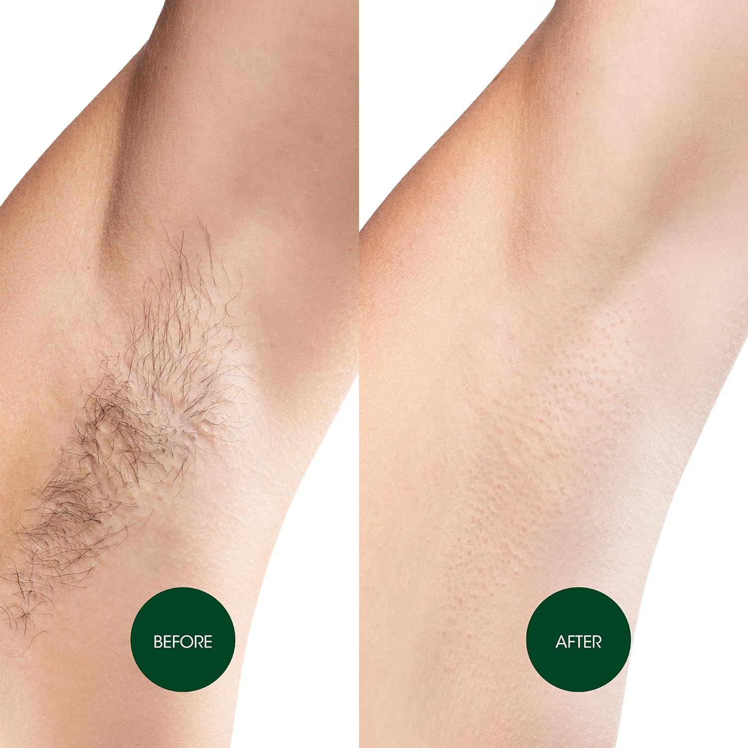 Nad's Body Wax Strips Hair Removal For Women At Home plus 4 Calming Oil Wipes, 24 Count : Hair Removal Wax : Beauty & Personal Care