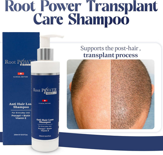 Anti Hair Loss Shampoo For Everyday Use – Enriched With Procapil, Biotin & Vitamin E – Supports Stronger, Fuller Hair – Ideal For After Hair Transplant & Post-Operation Care
