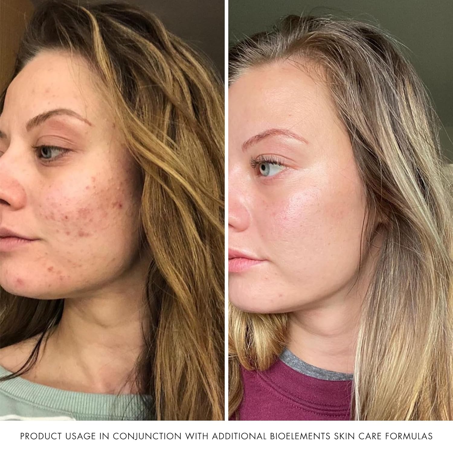 Bioelements Raydefense - 4 Fl Oz - Hydrating Broad-Spectrum Spf 30 Sunscreen & Moisturizer For All Skin Types - Vegan, Gluten Free - Never Tested On Animals : Beauty & Personal Care