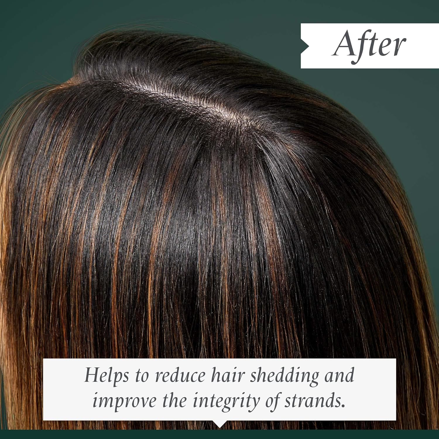 Philip Kingsley | Density Preserving Scalp Foam | Treatment Volumising for Thinning Hair and Hair Loss | Fine, Flat, Thin Hair Volumizer Lifting Foam | Helps Add Texture and Lift Roots | 120ml : Amazon.co.uk