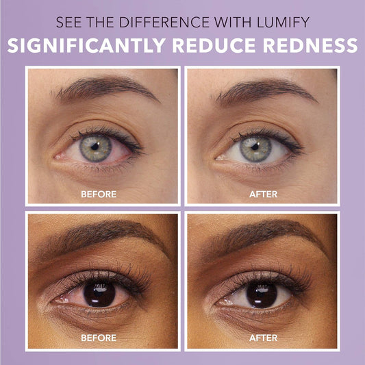 Lumify Redness Reliever Eye Drops 0.25 Ounce (7.5Ml)