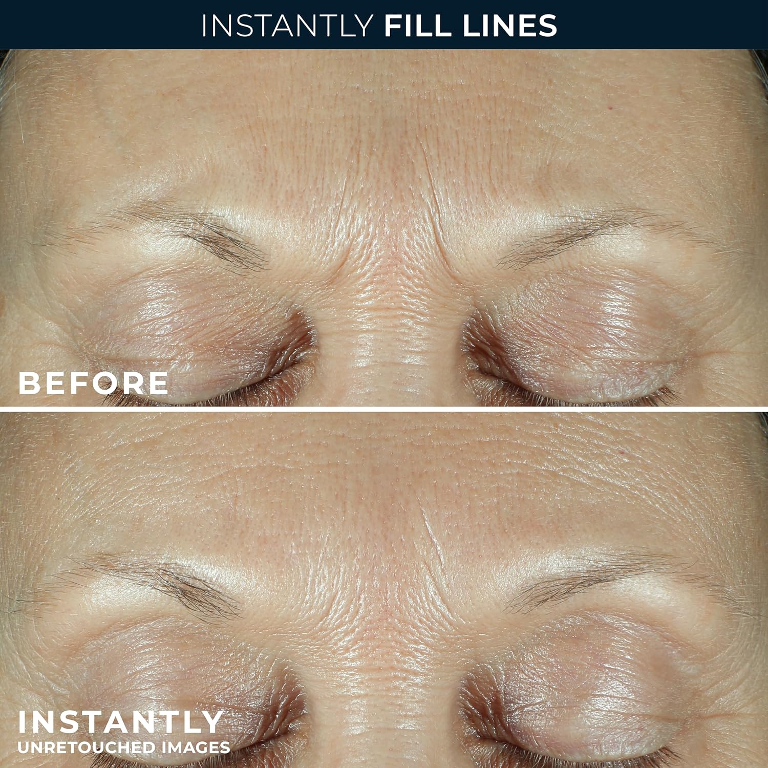 Roc Derm Correxion Contour Cream | Firming Moisturiser For Face & Neck With Retinol | 50 Ml