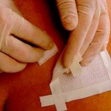 Adhesive Remover Remove Wipe 50 per Pack Count of 50 By Smit