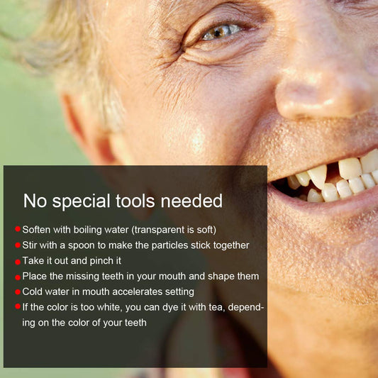 Temporary Tooth Repair Beads Temporary Crowns Filling Material With Broken Teeth Tooth Filling Kit Multifunction Temporary Tooth Repair Set Plastic Replacement Tooth Kit For Missing Tooth ()