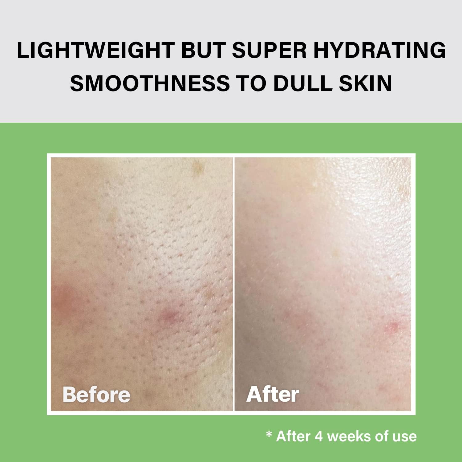 celimax Noni Moisture Balancing Toner | with Noni Extract, F