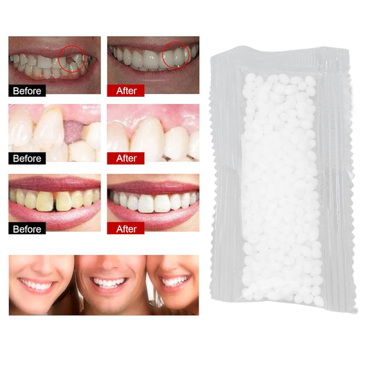 5 Bags Tooth Repair Tooth Solid Gel Temporary Repair Kit Moldable Thermal Fitting Bead Teeth Pellet Adhesive for Halloween Scary Themed Party Makeup Filling Fix the Missing Broken Tooth
