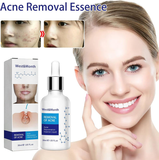 Sunlucky Acne Repair Essences Antis Wrinkle Essences Exfoliating Closed Blackheads Acne Pore Shrinkage Gentle Moisturizing 30 Oil for Face Before Makeup (White, One Size)