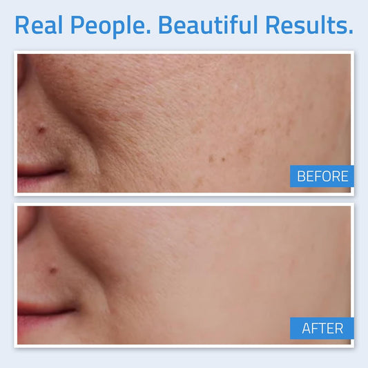 Yeouth Regenotin Advanced Collagen Generator For Skin, Nails, Hair And1.59 Ounces