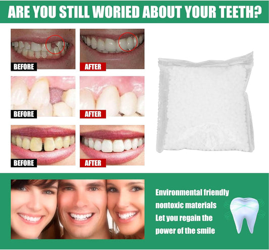 50g Tooth Solid Gel Temporary Repair Kit, Degradable Tooth Repair Beads Thermoplastic Beads, Replacement Teeth Filling Fixing Beads for Broken Missing Teeth