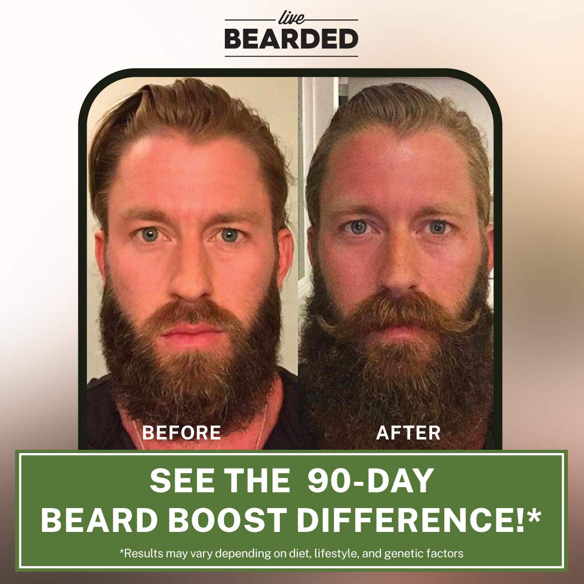 Live Bearded: Beard Boost - Beard Hair Growth Multivitamins with Bioti