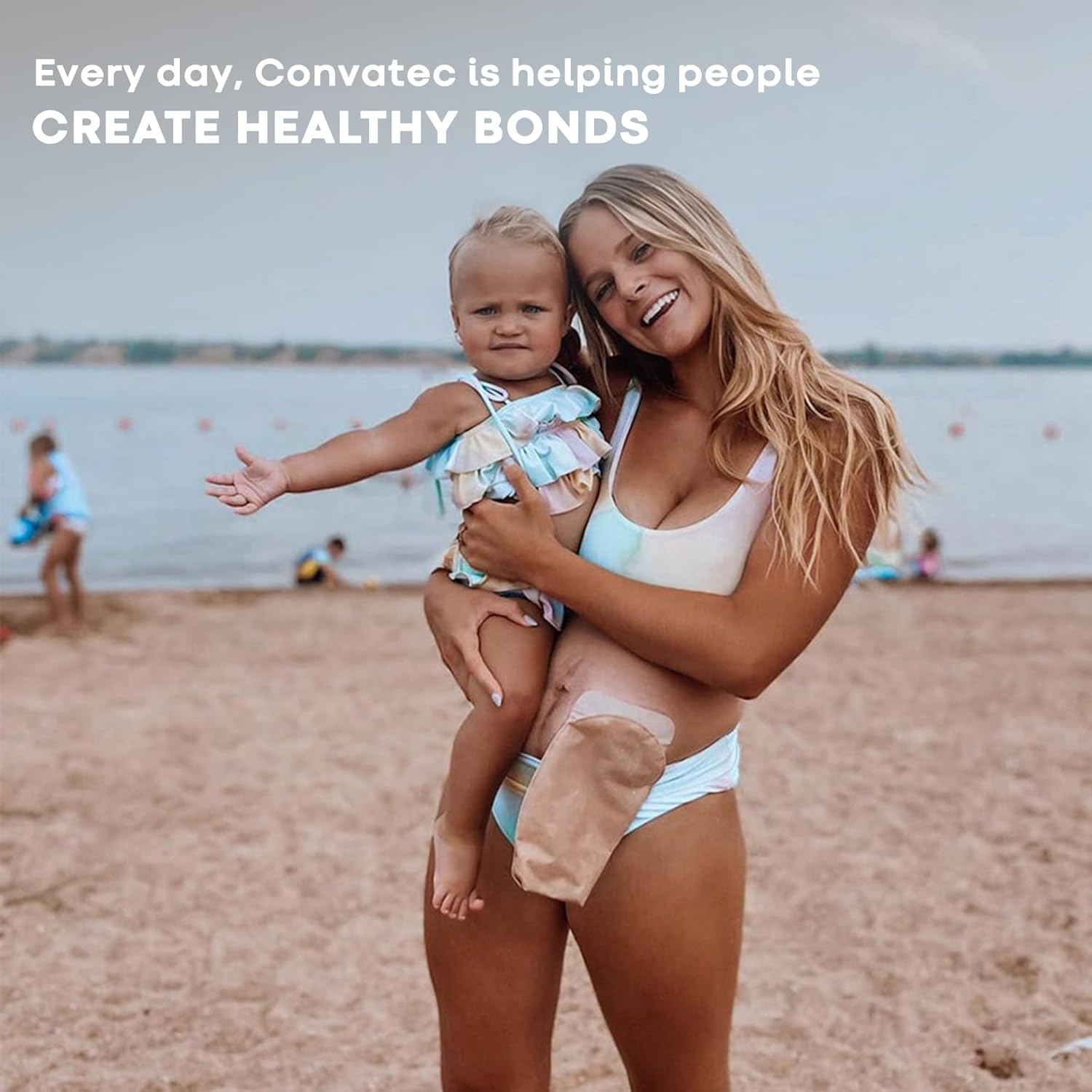 ConvaTec ESENTA Skin Barrier for Protection Around Stomas an