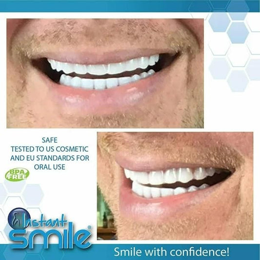 Instant Smile Complete Makeover Set – Bright White Matching Veneers | Comfort Fit Flex Cosmetic Teeth | One Size Fits Most | Natural-Looking Upper Veneer