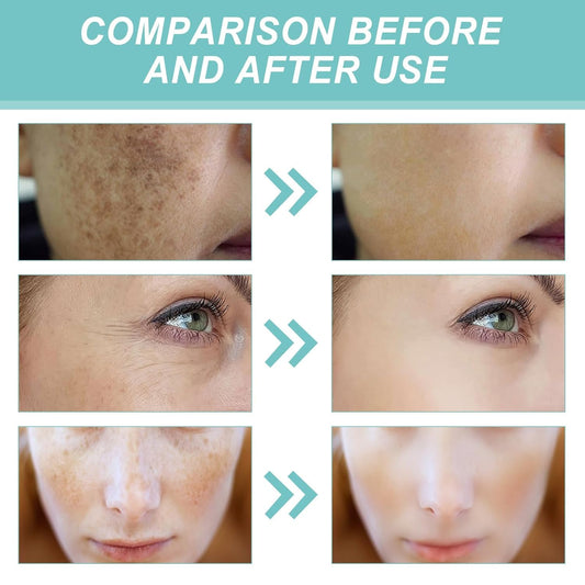 Brightening Face Cream | Helps Reduce the Look of Dark Spots & Uneven Skin Tone