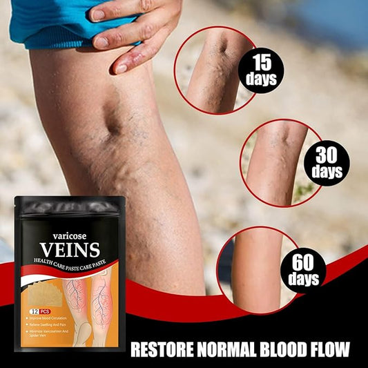 Turmeric Varicose Vein Patch, Vein Patch, Varicose Veins Treatment for Legs, Spider Veins Removal for Legs Patch, Improve Blood Circulation, Soothing Leg Fatigue- 1 Pack