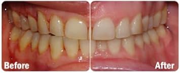 Probiora Oral-Care Chewable Probiotic Tablets | Probiotic Supplement For Women & Men | Healthier Teeth & Gums | Fresher Breath | Whiter Teeth | 60 Count | Mint : Health & Household