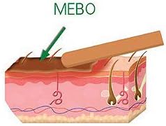 Mebo Burn Cream Skin Healing Ointment Wound & Scar No Marks Care Fast First Aid Health Beauty Care (1 Tube = 15 Grams) : Health & Household