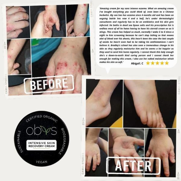 Obvs Skincare Intensive Skin Recovery Cream Organic 100Ml