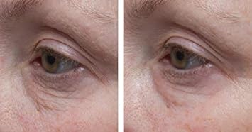 Dr. Denese Skinscience Firming Facial Collagen Eye Cream Face Moisturizer Hyaluronic Acid & Peptides Rejuvenate Skin - Improved Look Of Fine Lines, Elasticity, Sagginess, Bags - Cruelty-Free - 1Oz