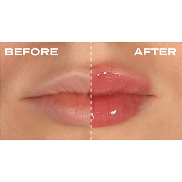 Plump It! No Needles Lip Filler Kit 2X 3Ml