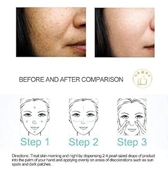 Dr Rashel Fade Dark Spots Face Serum - Reduces Pigmentation Smoother And Clear Skin - 1.69 Oz : Beauty & Personal Care