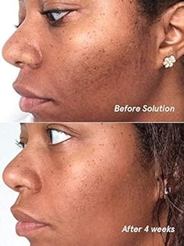 Glossier Solution Exfoliating Skin Perfector 4.4 Fl Oz / 130 Ml : Beauty & Personal Care