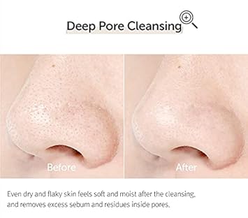[Dearklairs] Gentle Black Cleansing Oil 5.07 Oz | Composed Of Natural Vegan. Bean, Sesame, Black Currant Seed Oil For Gentle, Non-Irritating Cleanser For Sensitive Skin