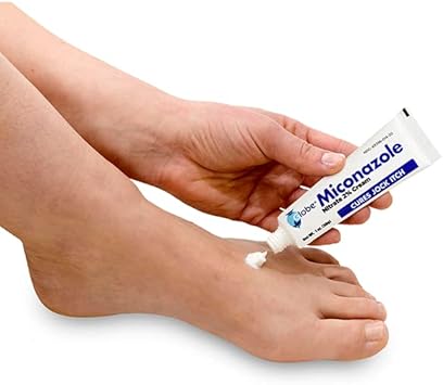 Globe Miconazole Nitrate 2% Antifungal Cream, Cures Most Athletes Foot, Jock Itch, Ringworm. 1 OZ Tube : Health & Household