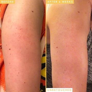 Farmacy Honeymoon Glow Body - Aha And Bha Body Serum With Hyaluronic Acid - Resurfacing Lactic Acid Body Lotion For Dry Skin : Beauty & Personal Care