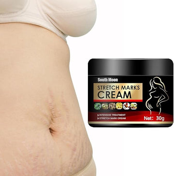 Stretch Marks Removal Cream - Scar Remover Cream for Pregnancy Skin Care, Stretch Marks and Scar Reduction