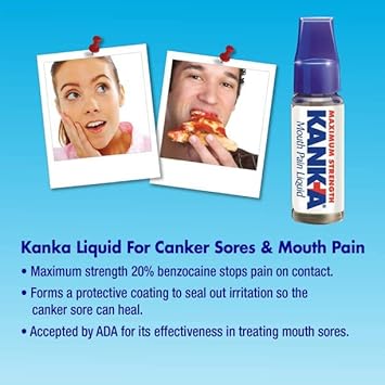 Kank-A Mouth Pain Liquid Professional Strength 0.33 Ounce : Health & Household