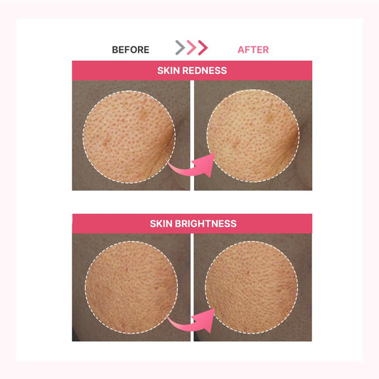 Avajar Red Collagen Hydrogel Mask | Hydrating & Firming Overnight Mask | Elasticity Improvement | Pdrn, Elastin, Hyaluronic Acid | 5P
