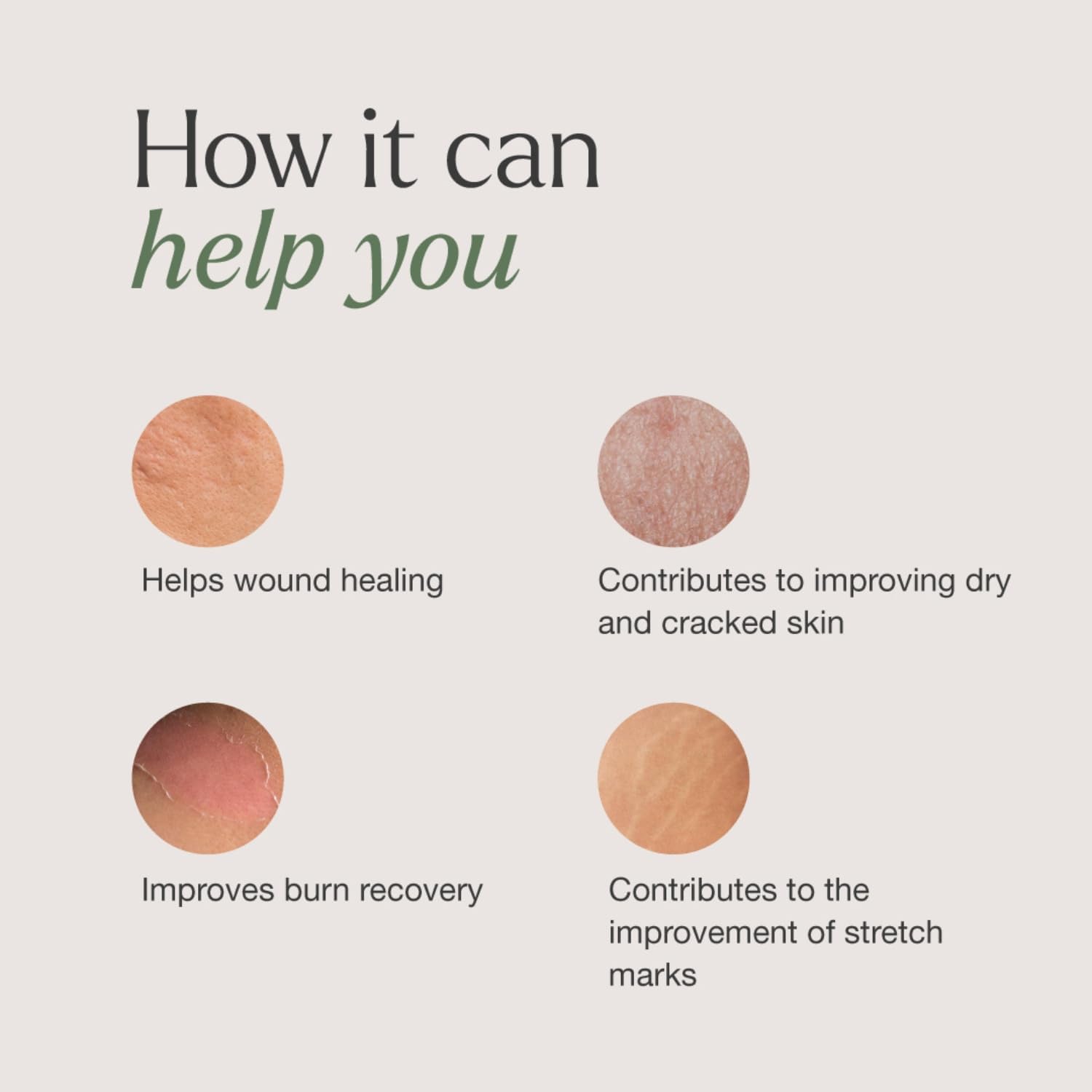 Oliovita Repair 100ml | Repairing Moisturizing Body Balm | Extremely Dry or Cracked Skin | Sea Buckthorn, Centella Asiatica, Mallow, Argan and Sesame Oil, Hyaluronic Acid and Soothing peptides : Amazon.co.uk: Beauty