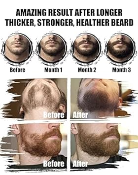 Beard Kit For Men Grooming And Care: With Shampoo & Conditioner, Beard Oil And Balm/Brush/Comb/Scissors, Father'S Day - Christmas - Birthday Gifts For Men Stocking Stuffers For Him/Husband