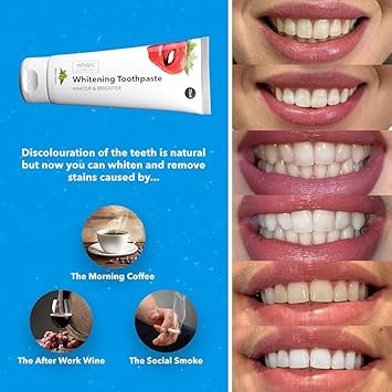 Whites Beaconsfield Advanced Teeth Whitening Toothpaste: Premium Oral Hygiene, Removes Plaque, Vegan & Cruelty-Free, Hydroxyapatite, Mint Flavour