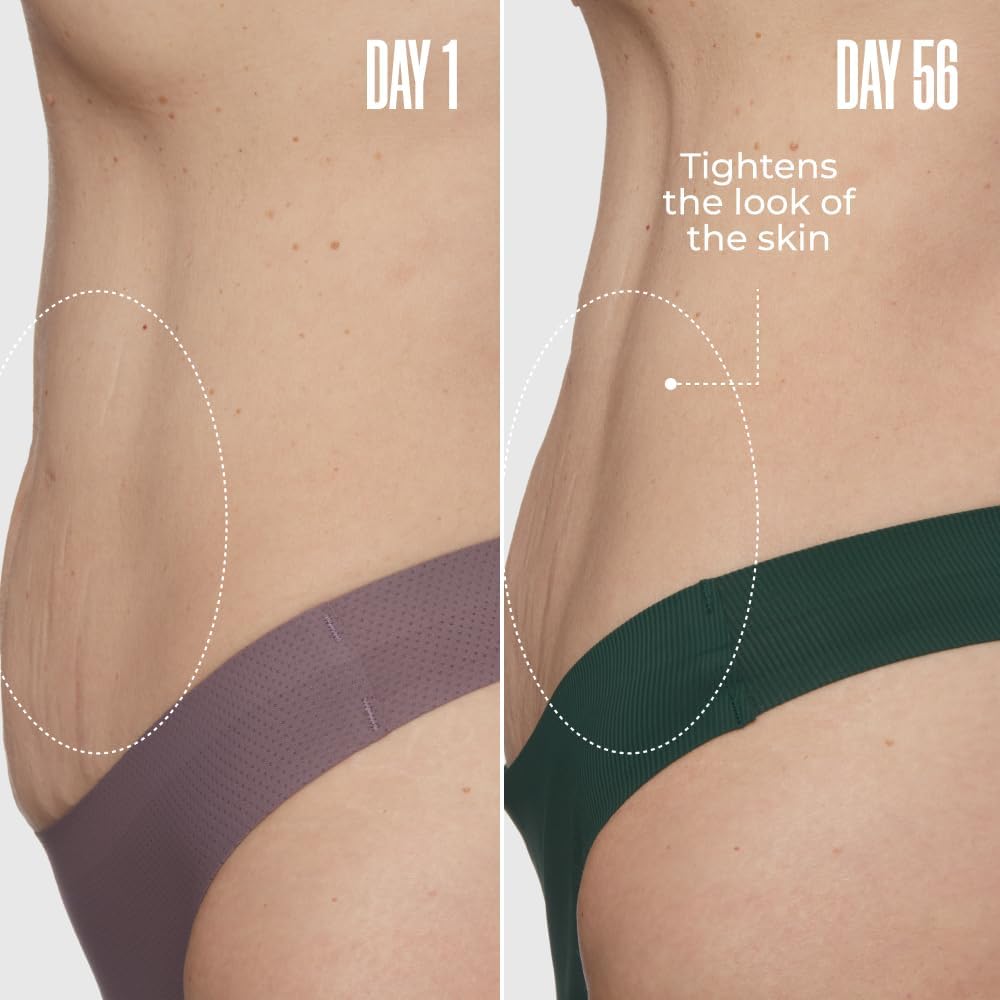 Maëlys Get-Dreamy Overnight Toning Body Whip - Body Firming Whip That Works While You Sleep - Helps Target The Appearance Of Loose Skin On The Body : Everything Else