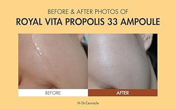 Dr.Ceuracle Royal Vita Propolis 33 Ampoule (30Ml / 1.01 Fl. Oz.) - Ultimate Glow And Nourish Vitamin Serum For Radiant Skin, Formulated With Propolis And Royal Jelly Extract