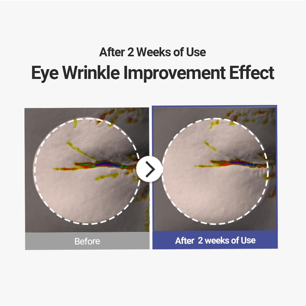 Avajar Rejuvenating Eye Wrinkle Control Mask | Targeted Eye Wrinkle & Fine Lines Patches | Firming And Tightening | Under Eye Patches | Boosting Elasticity | Pdrn, Niacinamide, Peptides | 5P : Beauty & Personal Care