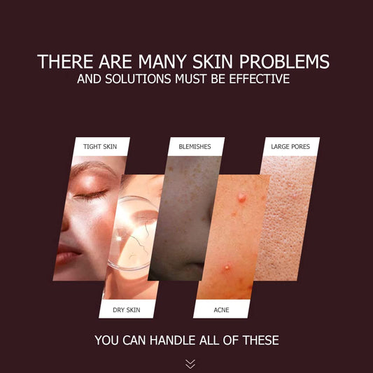 Bioaqua Aloe Vera Extract Pink Gel Hydrating Moisturizing Soothing Skin Care Essence 300G/10.58Oz