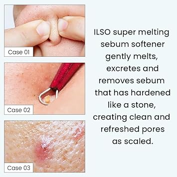 Ilso Super Melting Sebum Softener + 1/3 Saving Cotton Pad