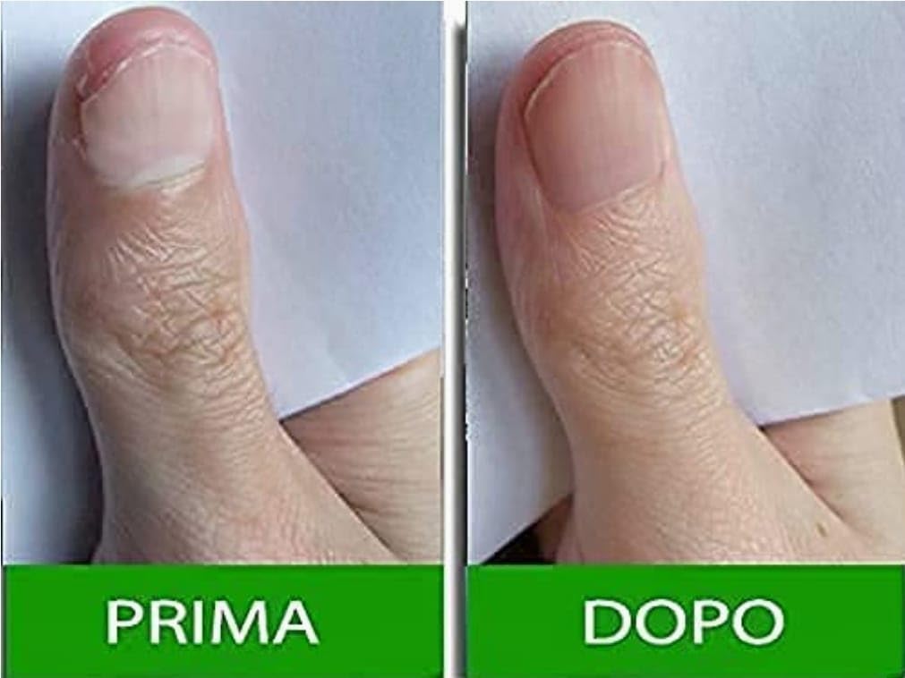 Pantogar (Pantovigar) Specific Treatment For Hair And Nails - 90 Cap : Beauty & Personal Care