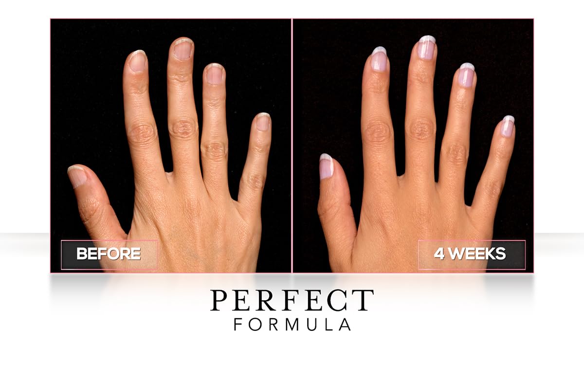 Perfect Formula Daily Moisture Treatment, 0.5 Fl Oz : Beauty & Personal Care