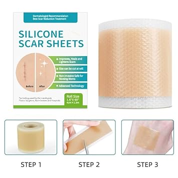Medical-Grade Silicone Scar Tape Roll, Waterproof Silicone Scar Sheets For Surgery, Swimming, 24H Adhesion, No Residue | Safe For Sensitive Skin & Scar Away, Silicone Sheets For Scars : Health & Household