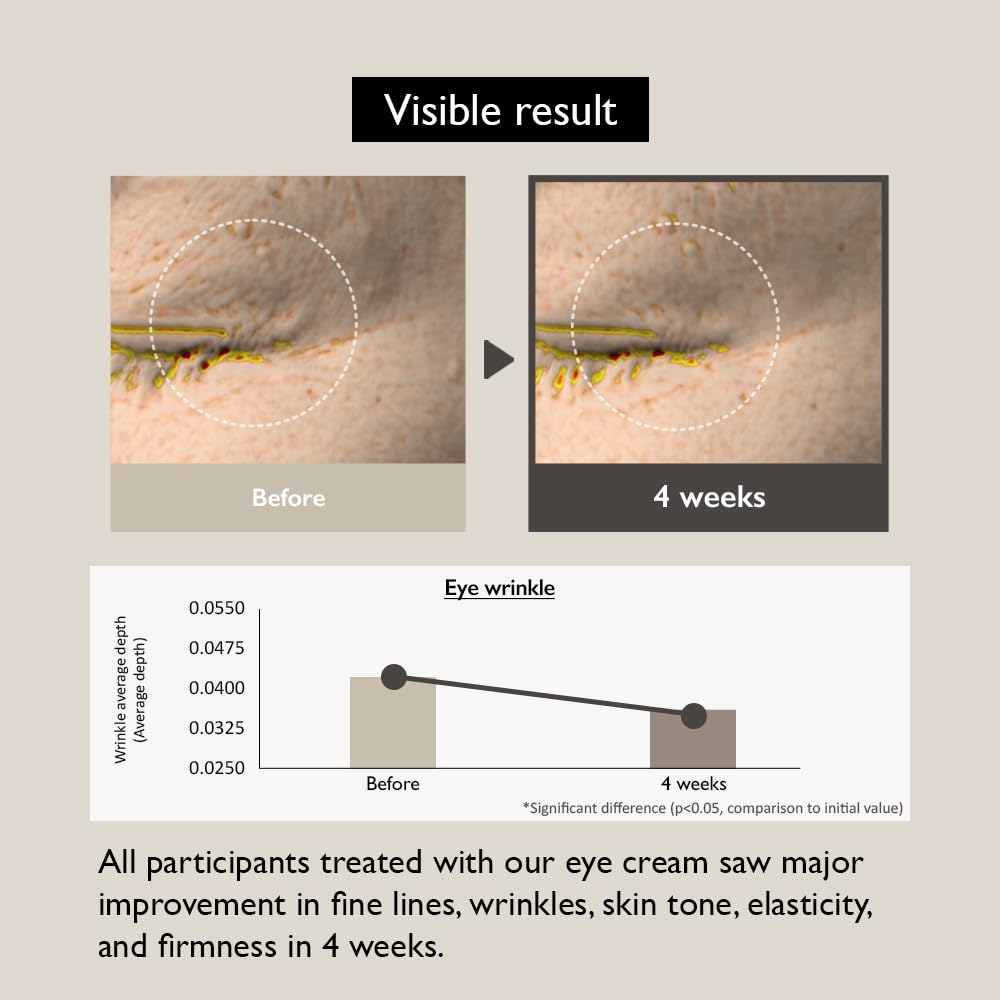 Haruharu Wonder Black Rice Bakuchiol Eye Cream & Black Rice Hyaluronic Toner For Sensitive Skin 150Ml Bundle : Beauty & Personal Care