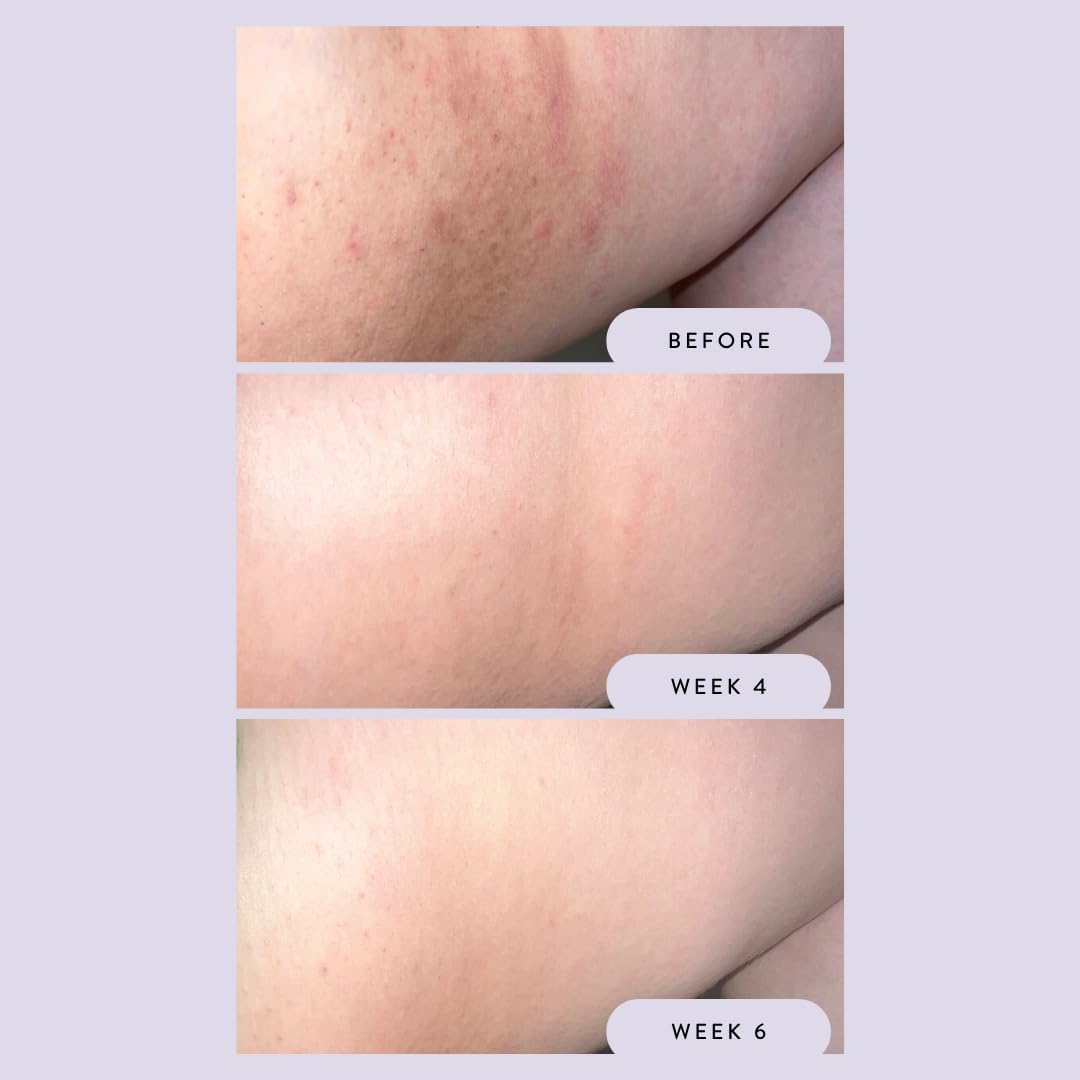 Megababe Night Rescue | Brightening & Soothing | 2.12 Oz : Beauty & Personal Care