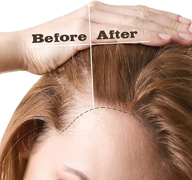 EBIN NEW YORK - MAX STRENGTH GROWTH OIL LIGHTWEIGHT - Unisex - 2.03oz (60ml) - Fast-Absorbing Hair Growth Solution with Nutrient Oils for Scalp Health, Breakage Control and Fuller Hair Appearance : Amazon.co.uk: Health & Personal Care