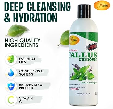 Spa Redi - Callus Remover For Feet Gel, Mint And Eucalyptus, 12 Oz - Professional Pedicure Foot Care - Removes Toughest Calluses In Seconds And Smooths Dry Cracked Heels