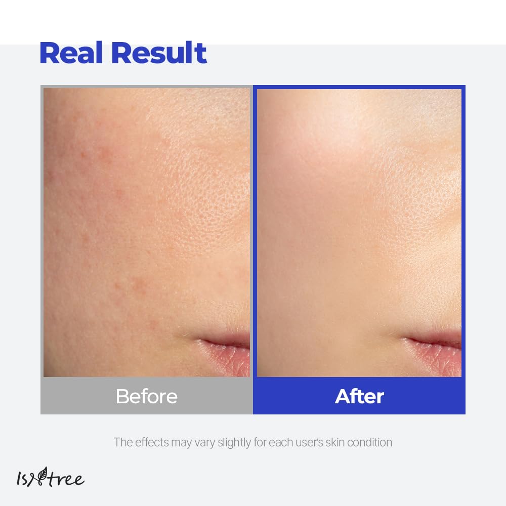 Isntree Hyaluronic Acid Aqua Gel Cream 100Ml, 3.38 Fl Oz | Korean Skincare | Lightweight Moisturizer | Quick-Absorbing Hydration | For Oily To Combination Skin : Beauty & Personal Care