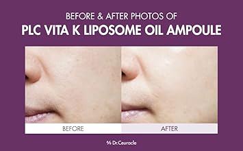 Dr.Ceuracle By Leegeehaam Plc Vita K Liposome Oil Ampoule (50 Ml / 1.69 Fl. Oz.) - Korean Vitamin K Facial Glowing Serum For Uneven Skin Tone & Dull Skin